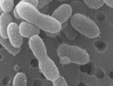 Sizce bu bakteri kaç yıl uyumuştur?