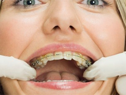 Beyaz dişler için pratik öneriler!